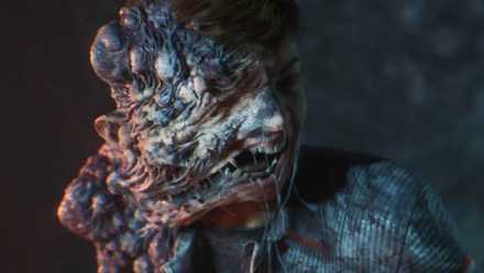 A character from Directive 8020 with bulbous alien flesh growing out of the side of their face.