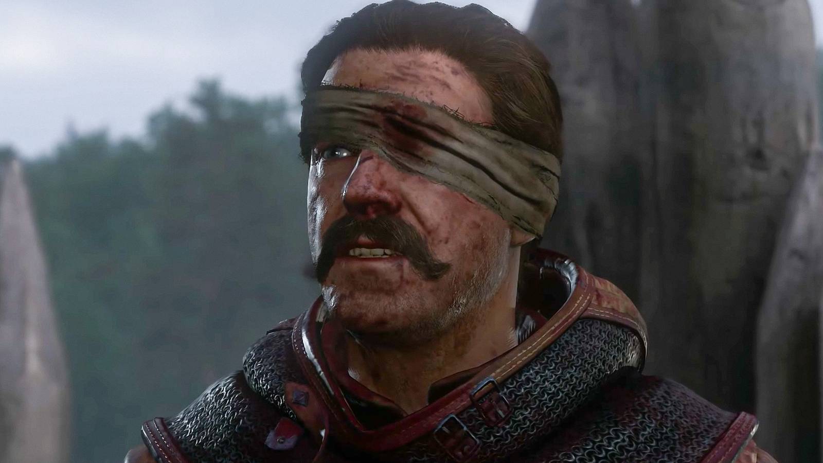 Jan Zizka in Kingdom Come Deliverance 2 with a bandage over his eye.