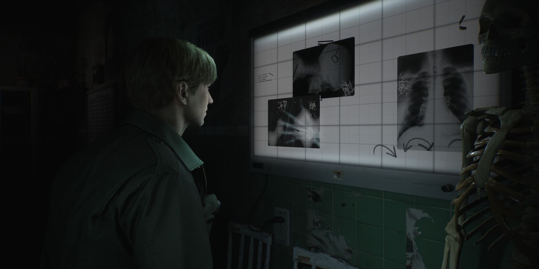 silent-hill-2-remake-key-art-james-in-xray-room.jpg