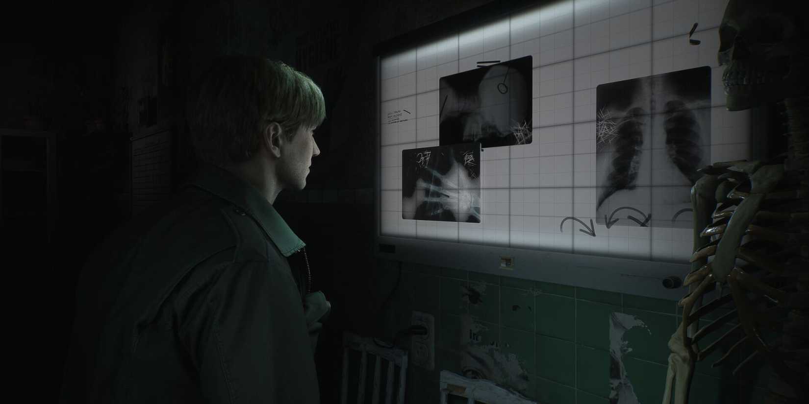 Silent-Hill-2-Cremake-Key-art-James-in-Xray-Room.jpg