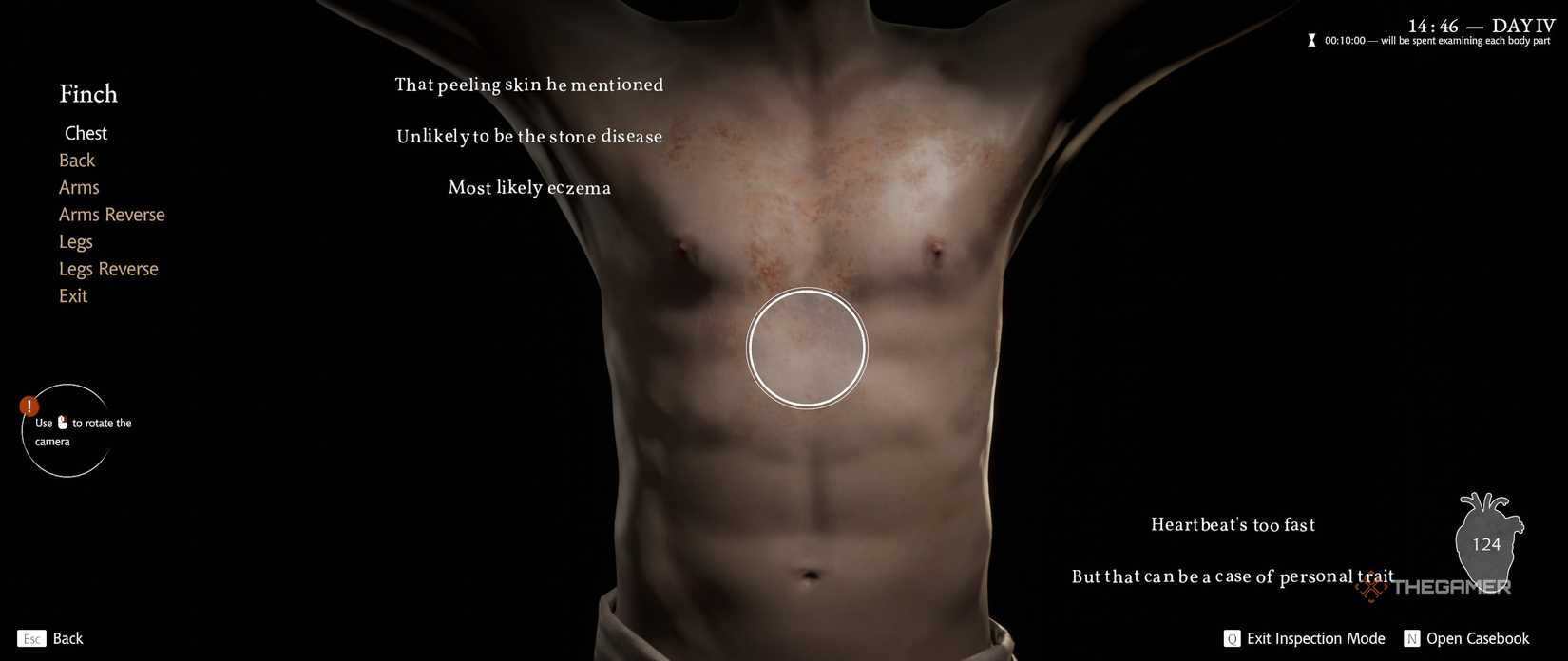 Examining the body of a male patient with peeling skin in Pathologic 3.